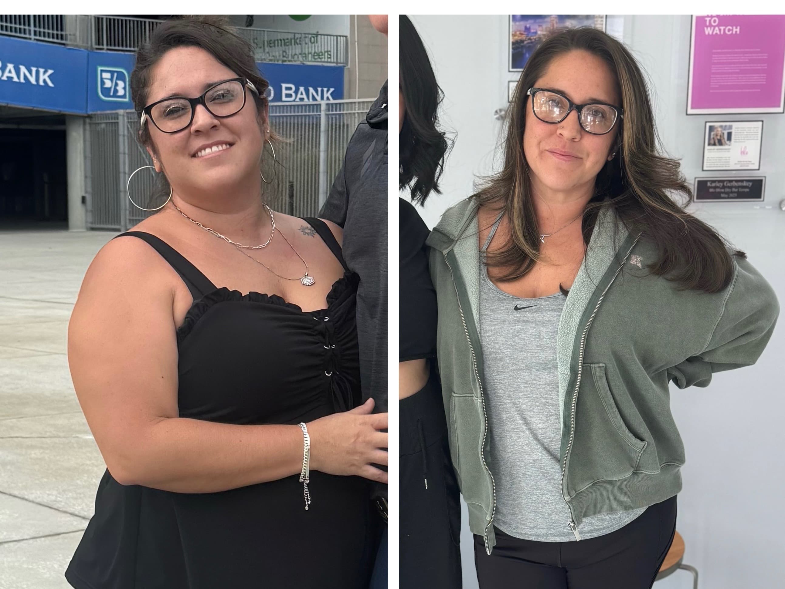 Before and after, real patient at Padgett Medical Center. Individual results vary.