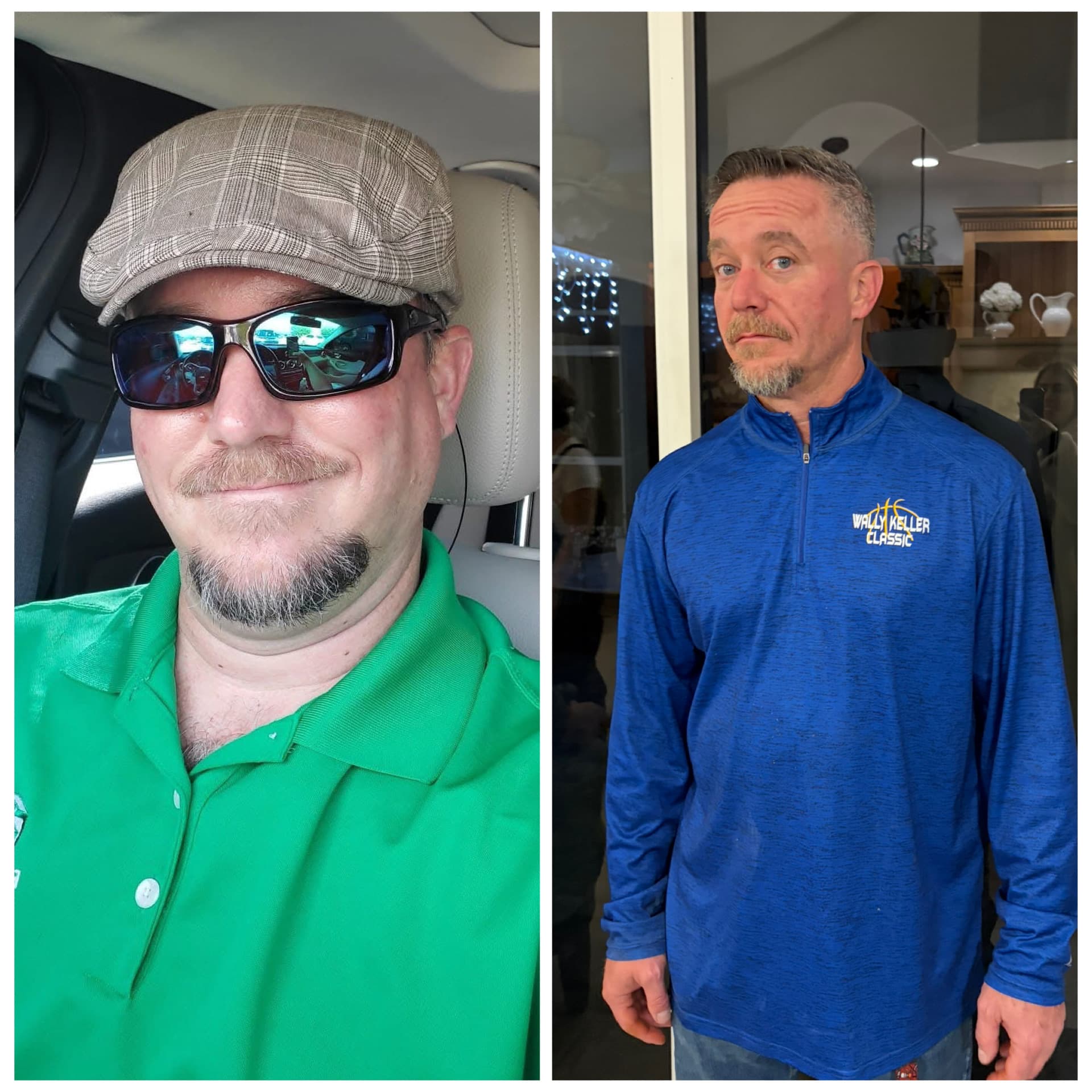 Before and after, real patient at Padgett Medical Center. Individual results vary.