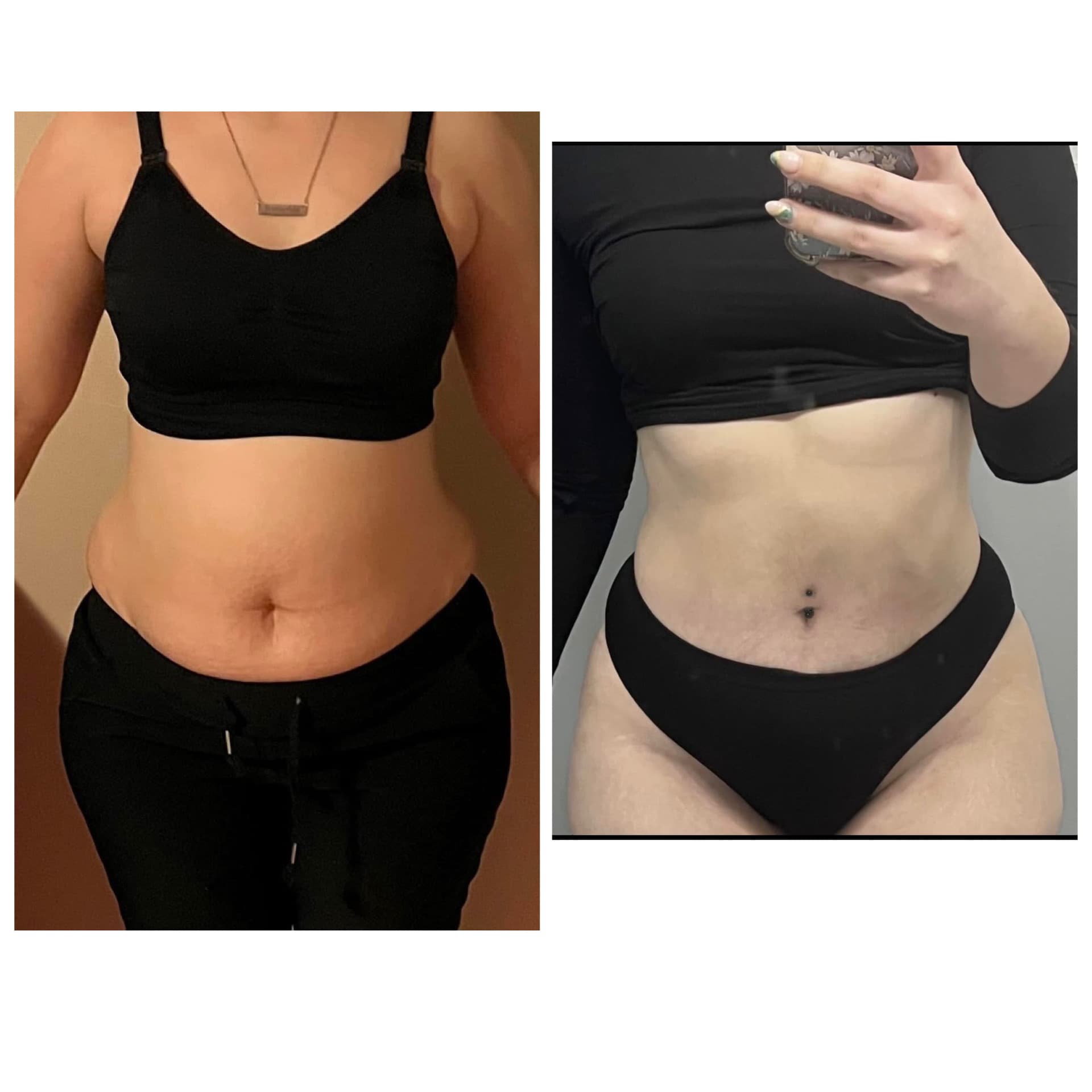 tirzepatide weight loss daytona beach Medical Drug Coast Spine Center Stuart Florida Chiropractor and Regenerative Medicine Cost of Tirzepatide for Medical